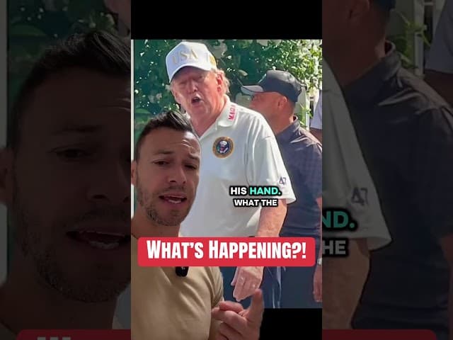 Trump's Hand Has People Asking WHAT Happened?! #Trump #Politics #News