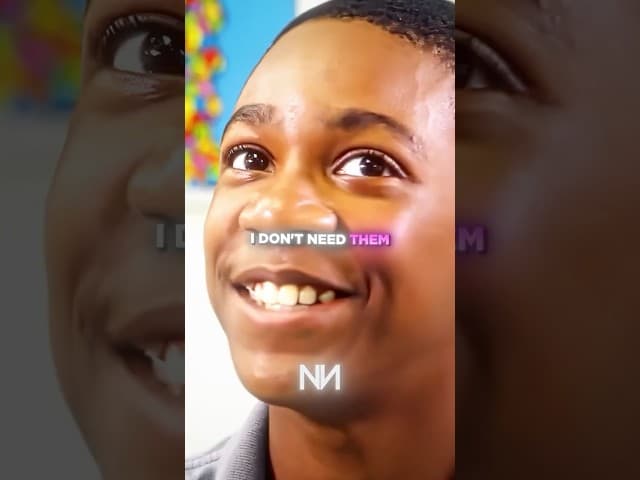 He Lost His Hands And Was Bullied For It…🥺❤️